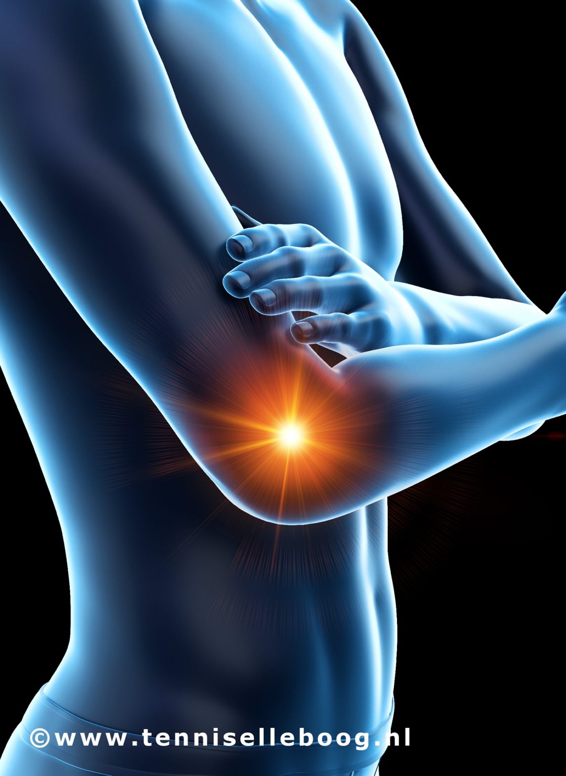 behandeling-therapie-behandeling-tenniselleboog-tennisarm